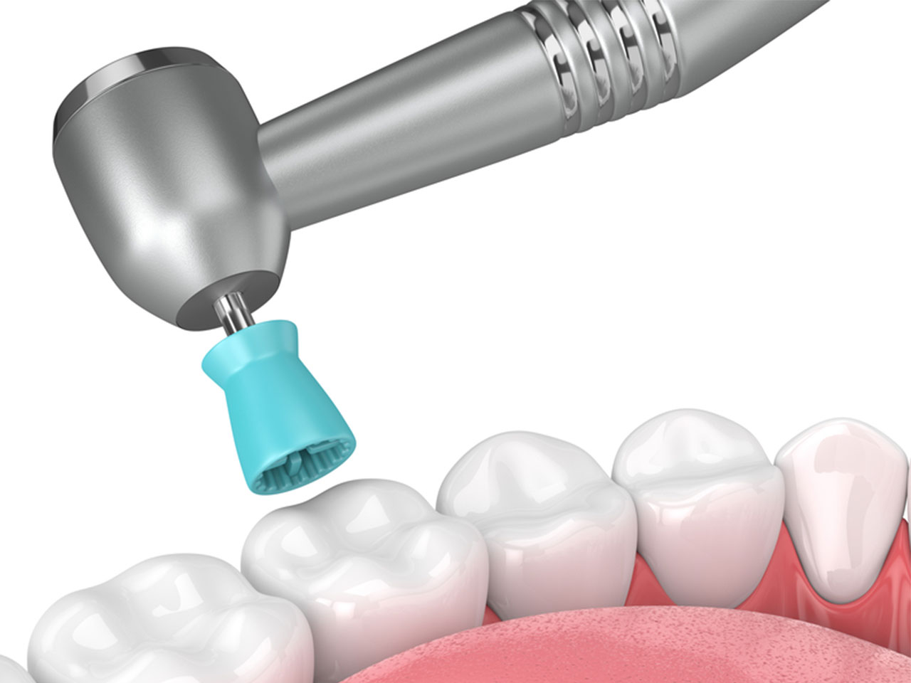 close up of coronal polishing instrument on illustrated teeth