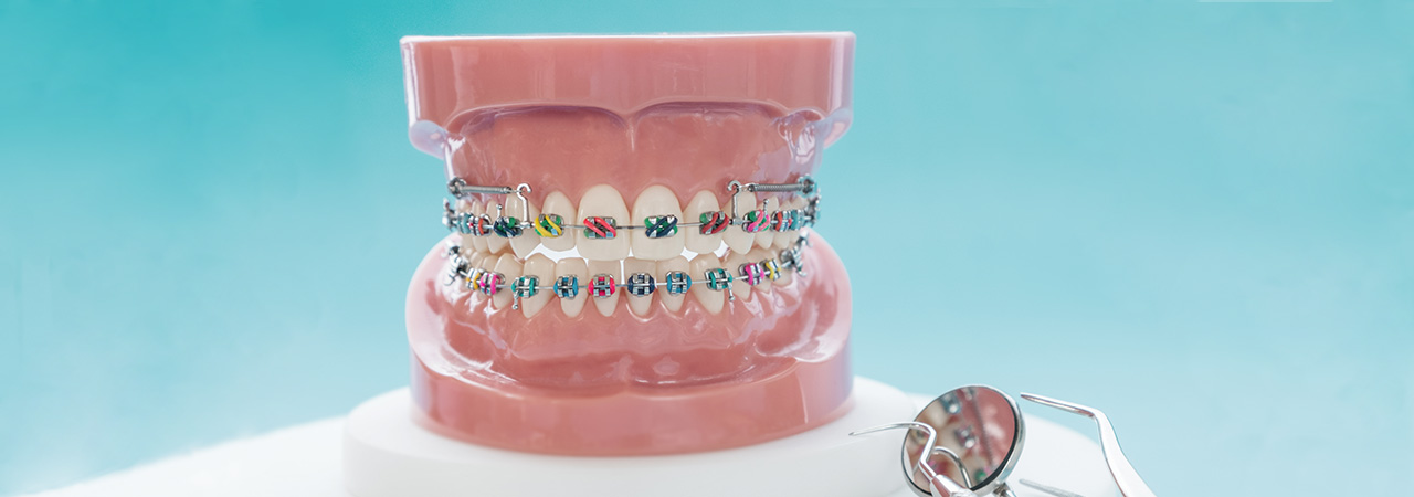 orthodontic assistant mouth and tools