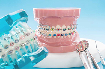 two models of mouths with colorful braces